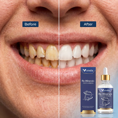 Virelia™ – Dentite Tooth Armor
