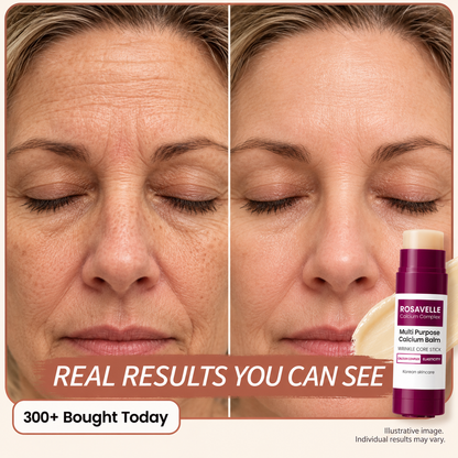 Rosavelle™ Calcium Complex Multi-Purpose Balm