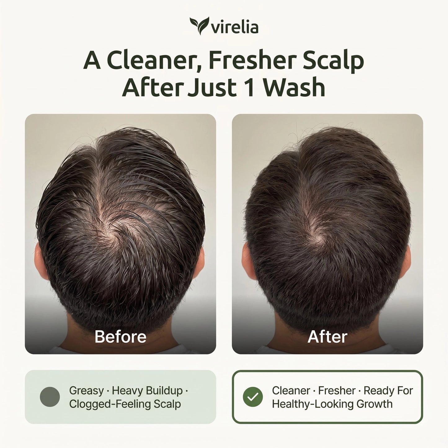 Virelia™ - Scalp Revival Bar