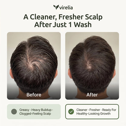 Virelia™ - Scalp Revival Bar