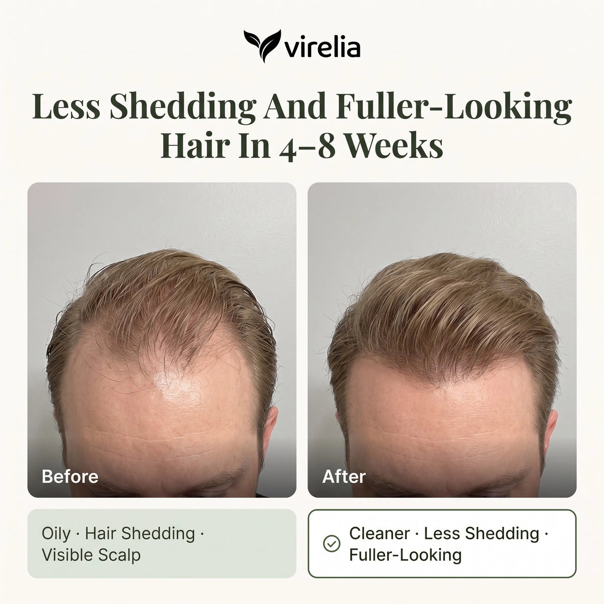 Virelia™ - Scalp Revival Bar